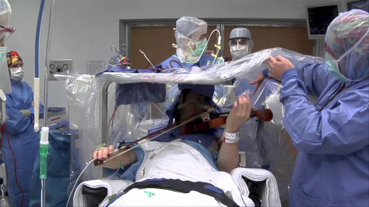 Woman Plays Violin During Her Brain Surgery